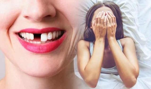 Nằm mơ thấy răng vỡ vụn là điềm gì?