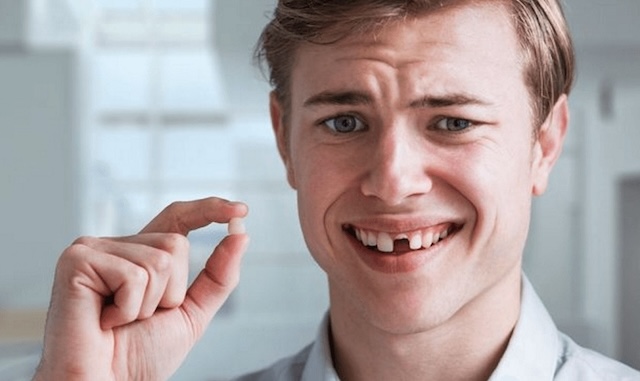 Giải mã chi tiết các giấc mơ về răng vỡ vụn